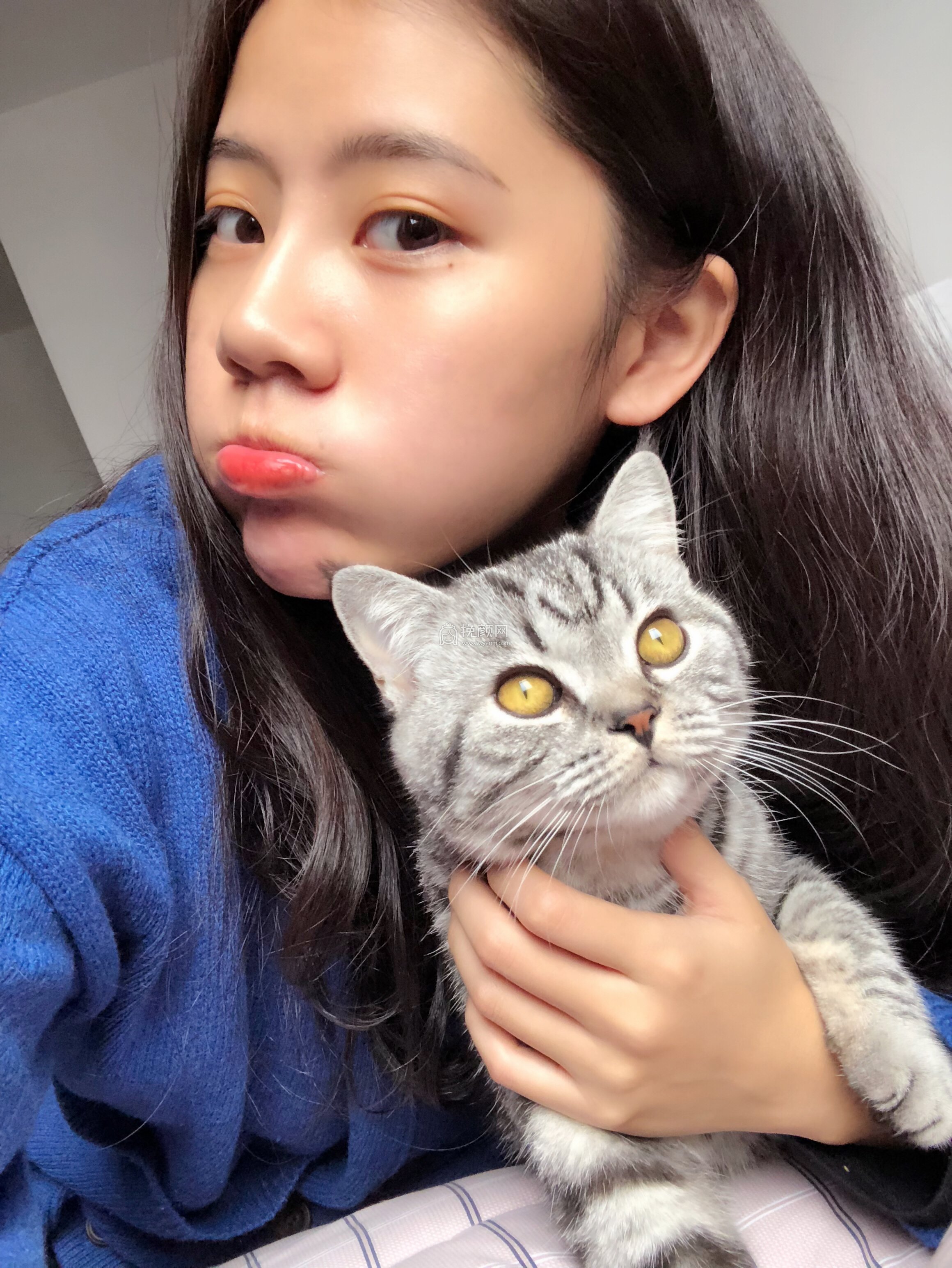 贵阳美贝尔医疗美容医生宋俊辉隆鼻案例分享!