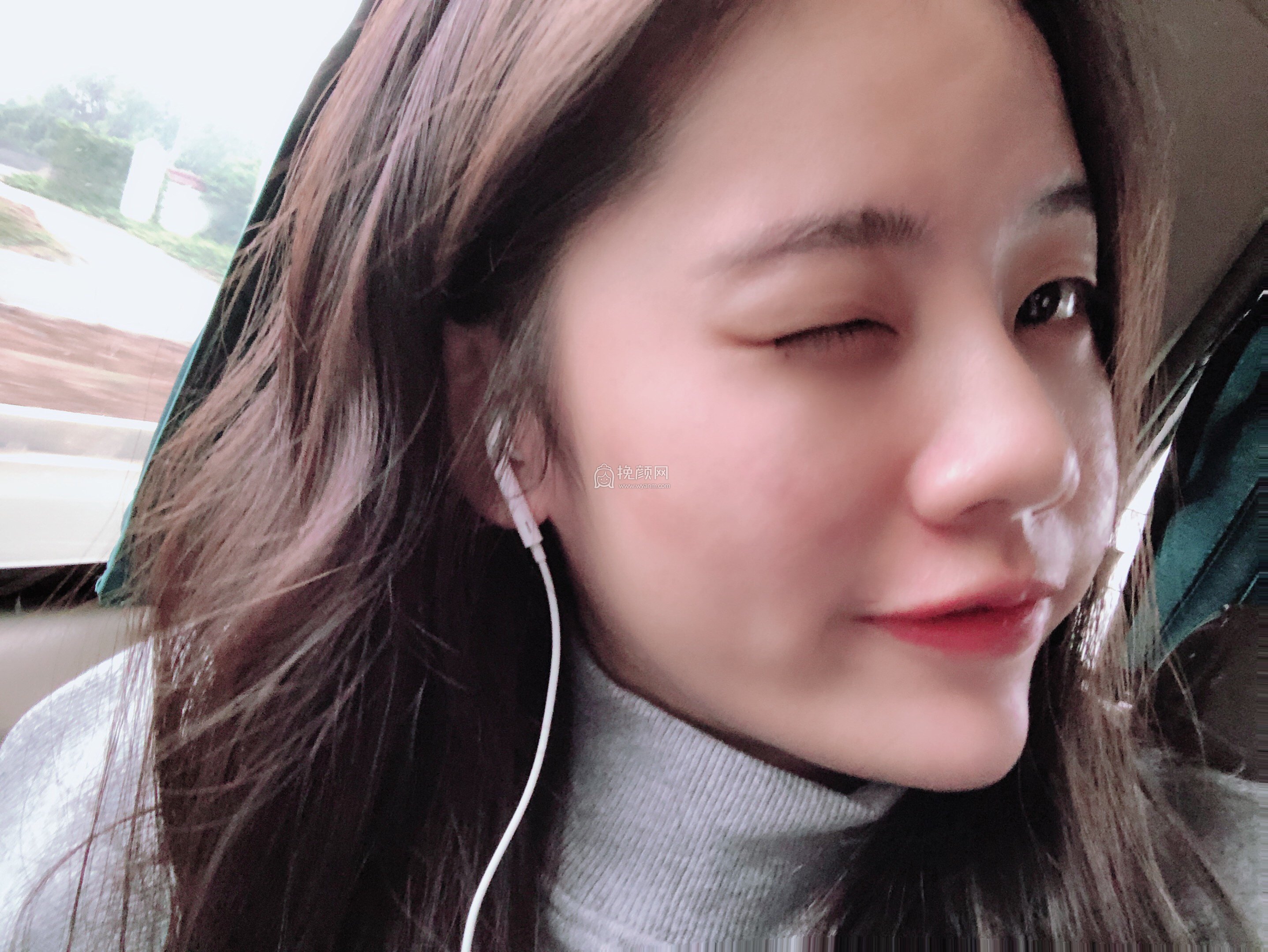 贵阳美贝尔医疗美容医生宋俊辉隆鼻案例分享!