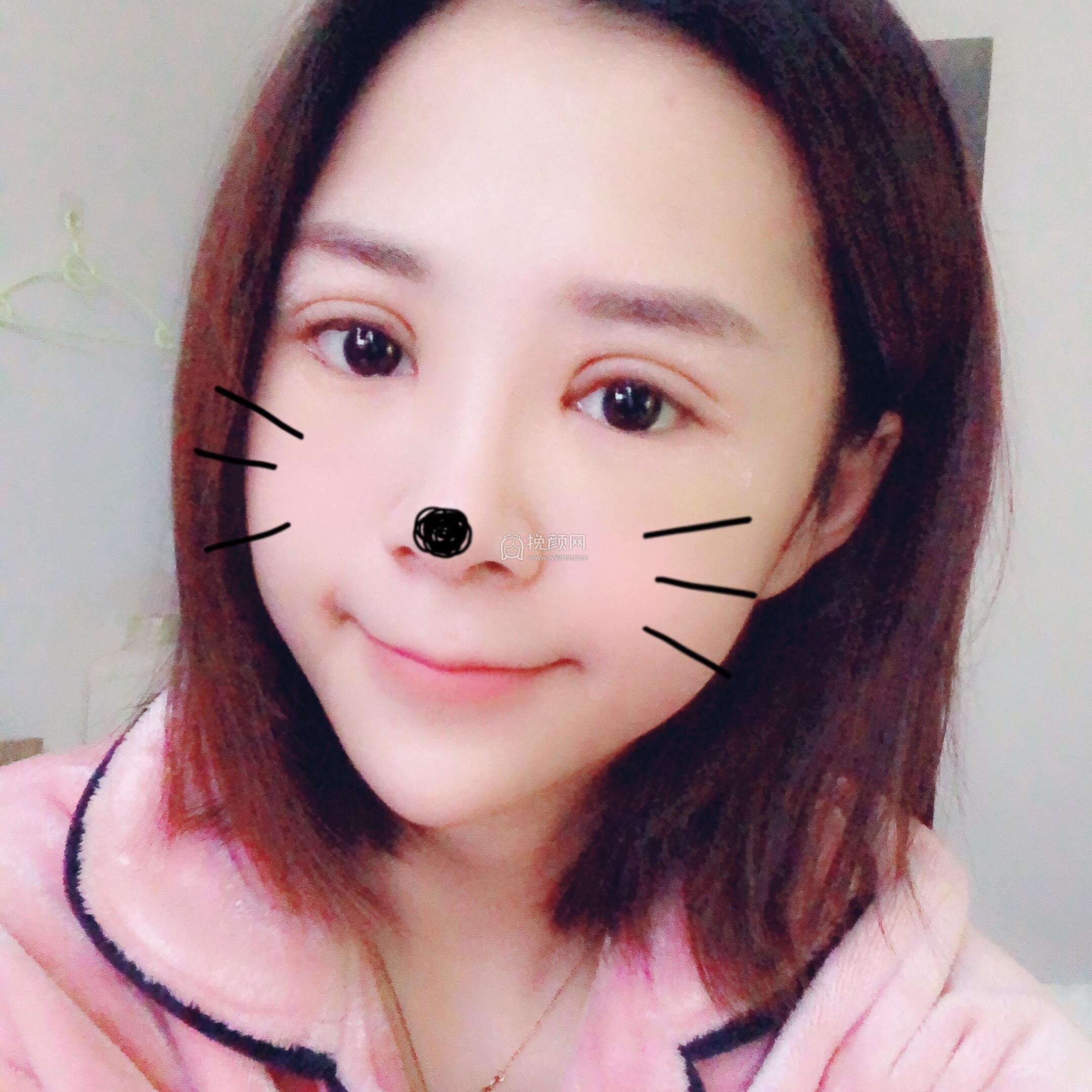 成都美未央医疗美容医院切开双眼皮怎么样?