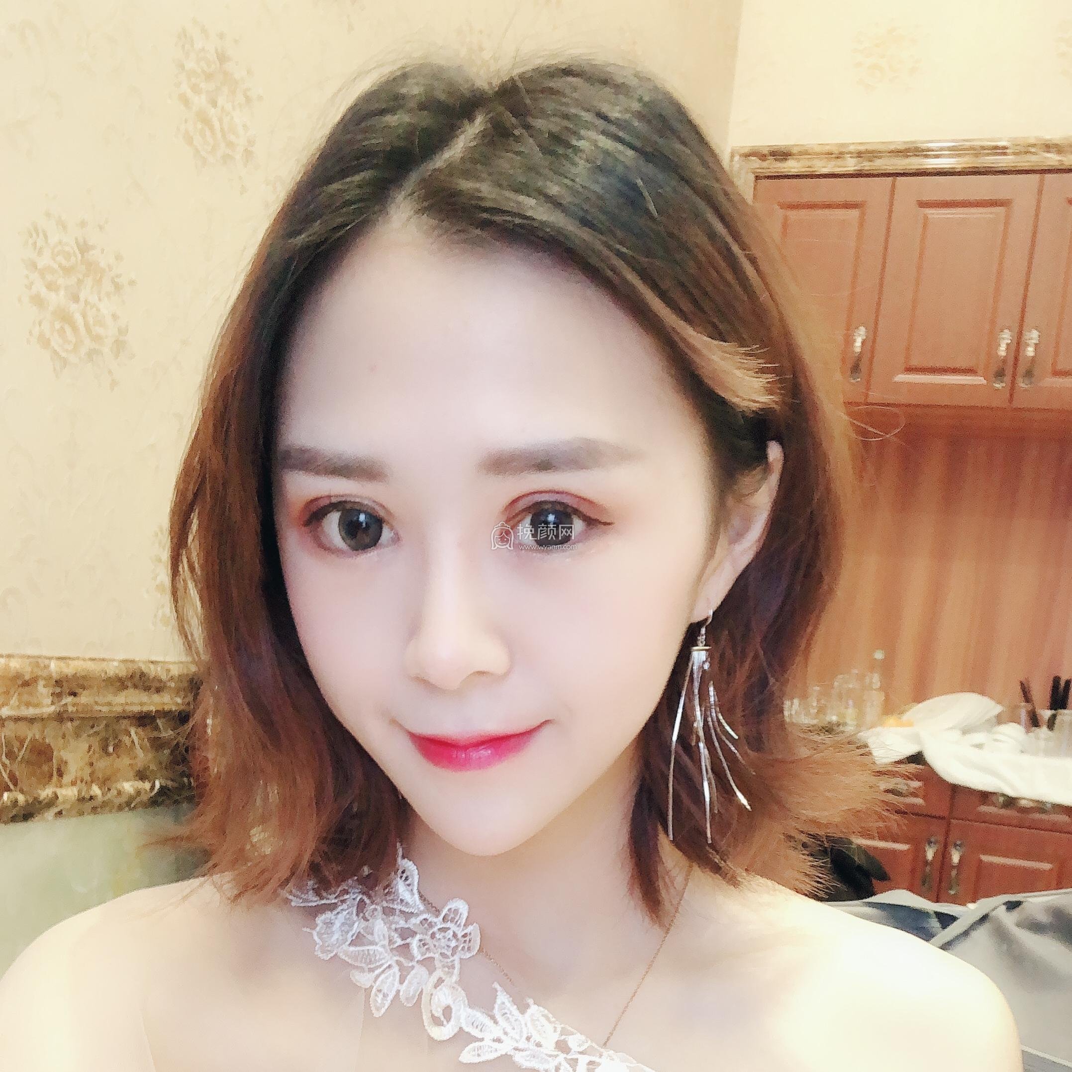 成都美未央医疗美容医院切开双眼皮怎么样?
