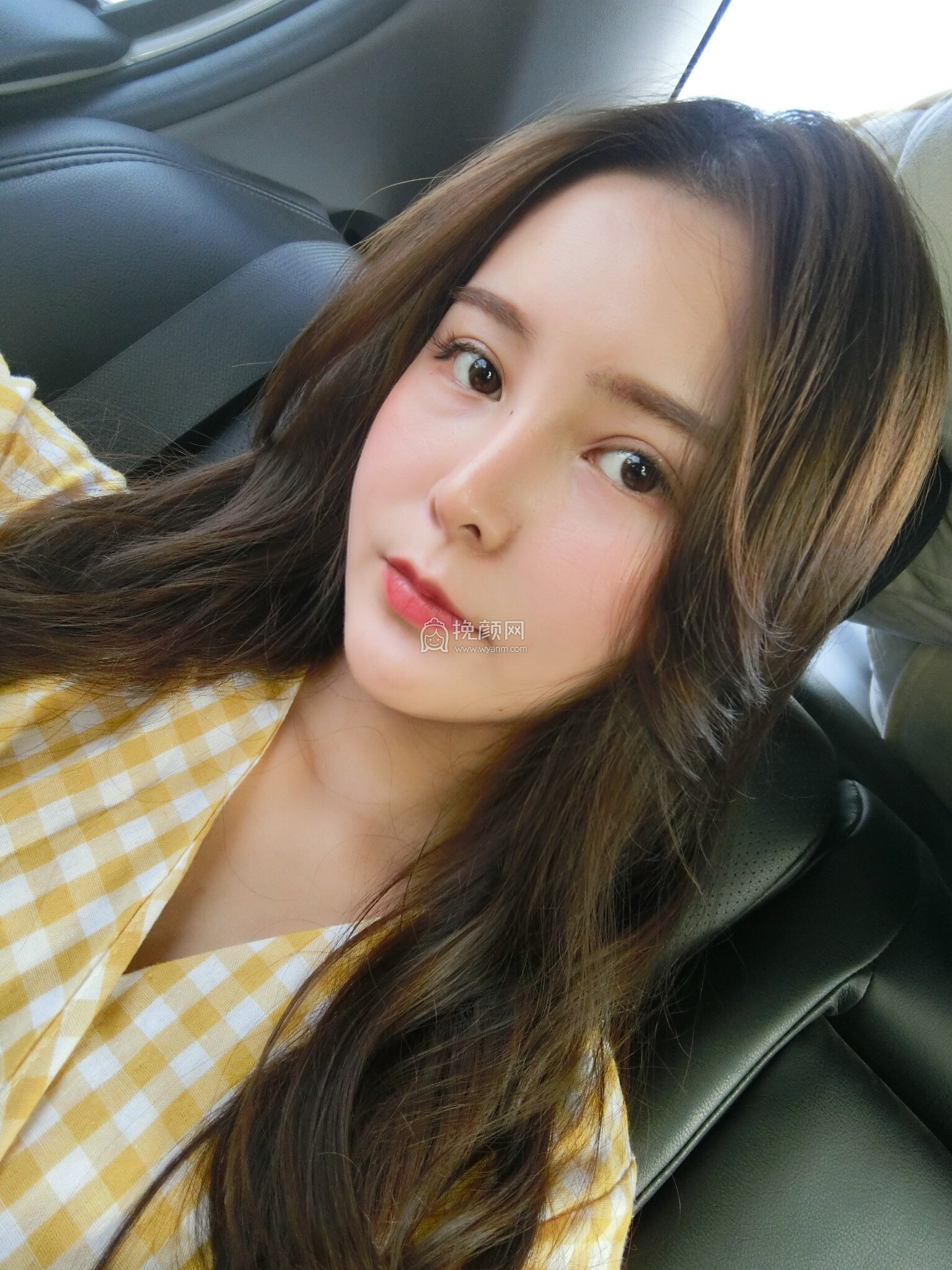成都天使之翼美容医院全脸自体脂肪填充案例分