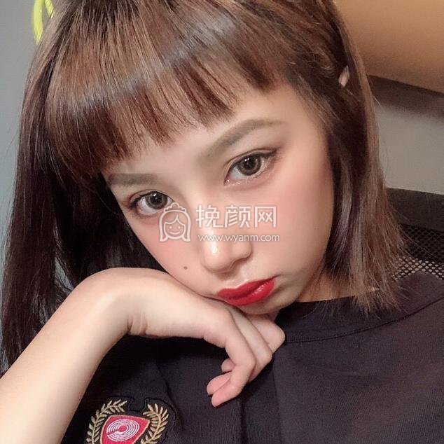 【肋软骨隆鼻】重庆新瑞俪李光强做得怎么样?