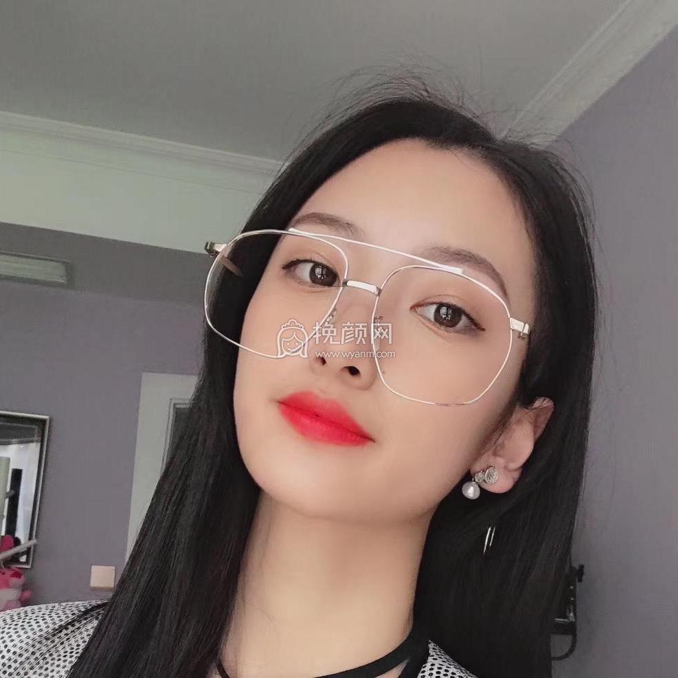 南京美贝尔黄名斗肋软骨隆鼻案例分享!
