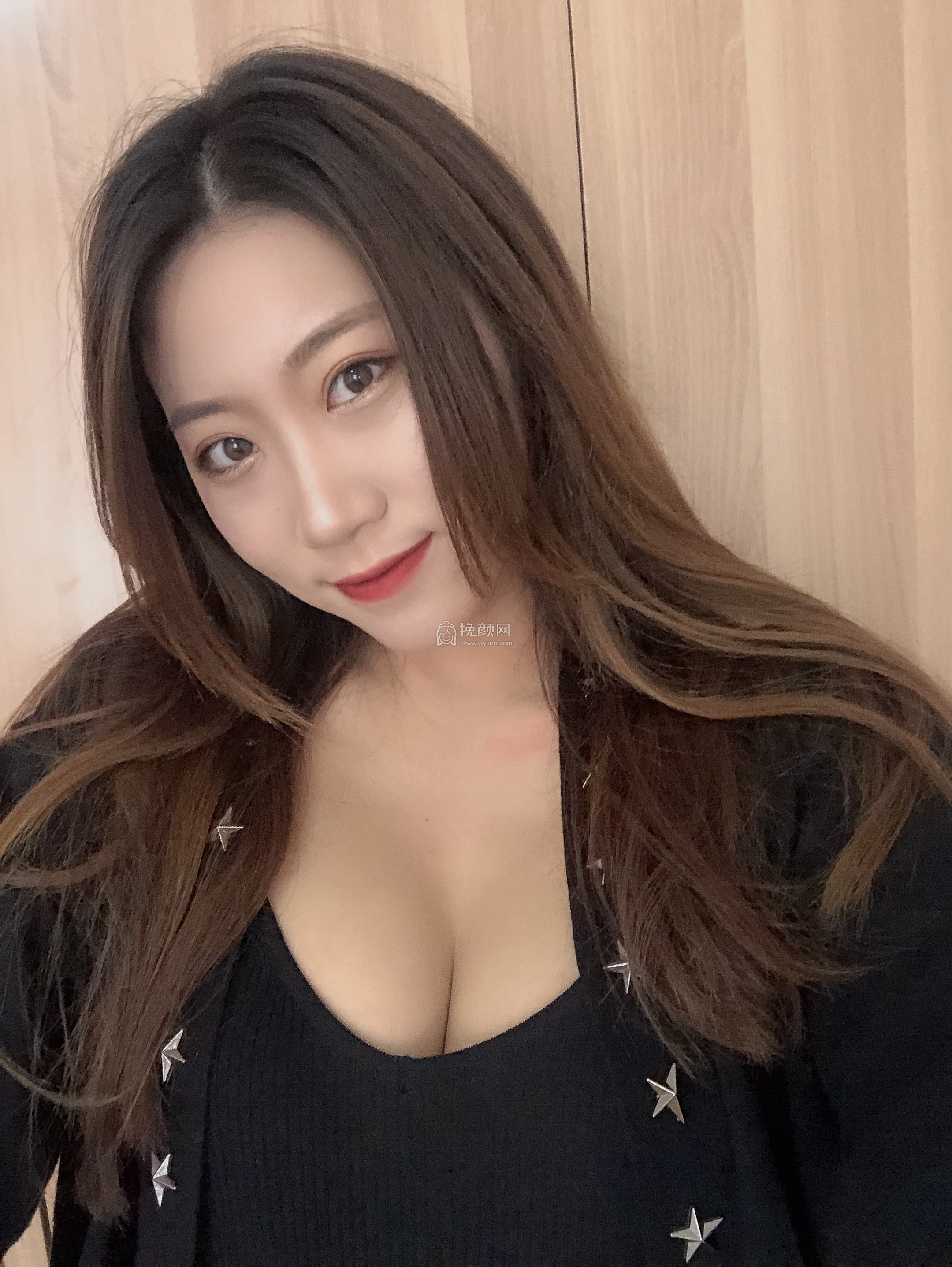 北京美莱董岩岩假体隆胸案例分享!