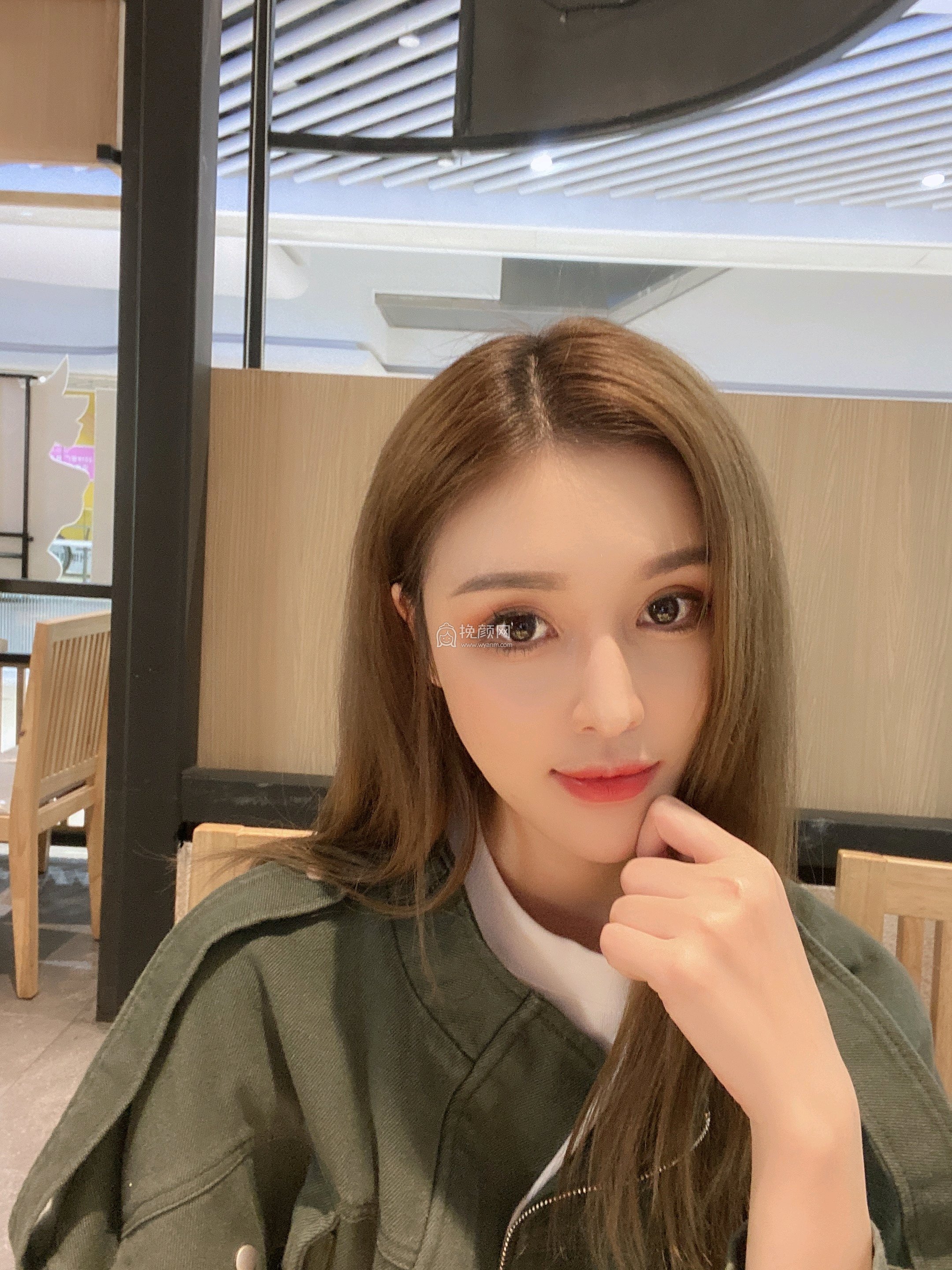 重庆美莱郑楠做的面部吸脂果怎么样?