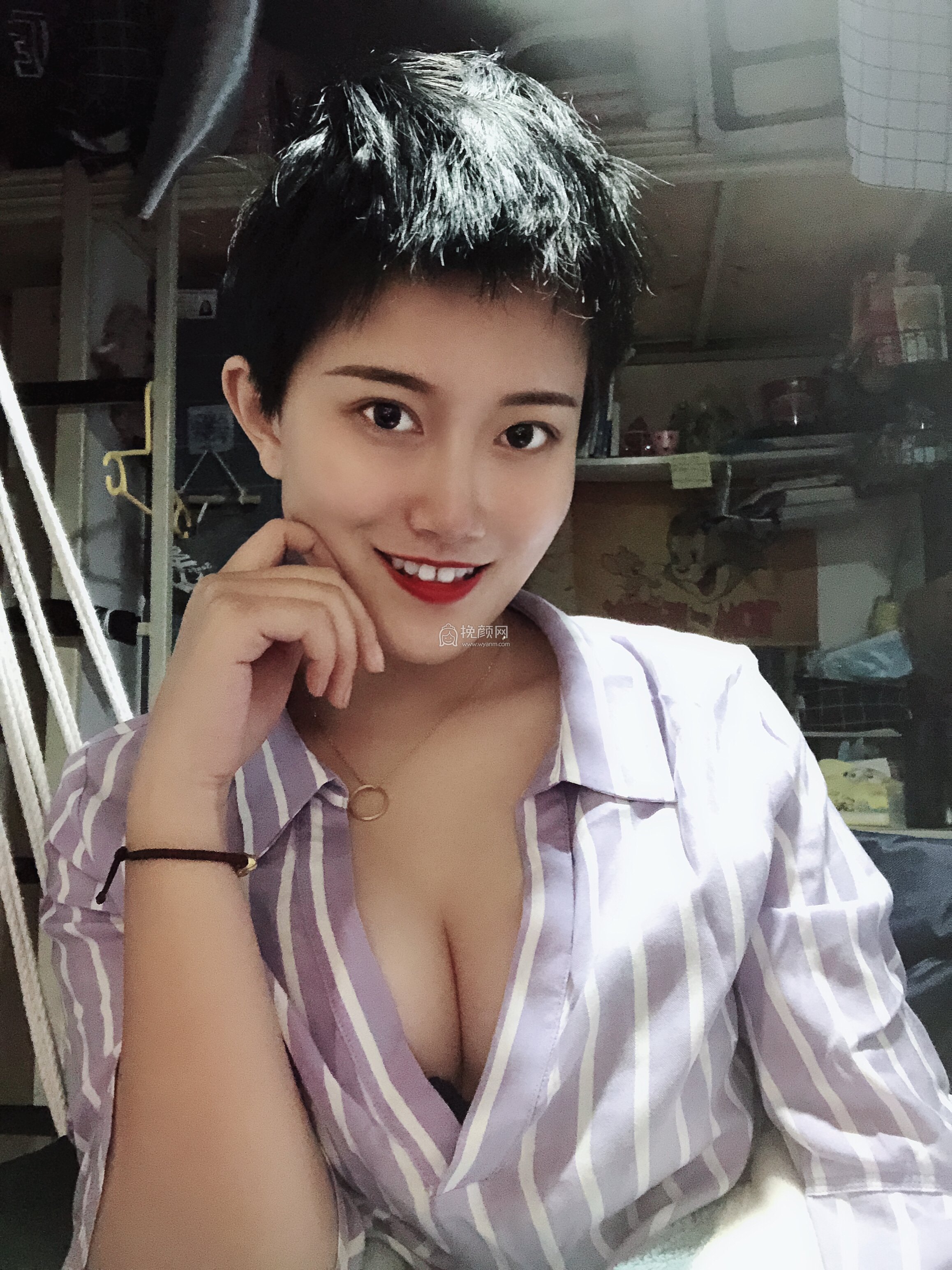 成都美上美罗通贵假体隆胸果怎么样?