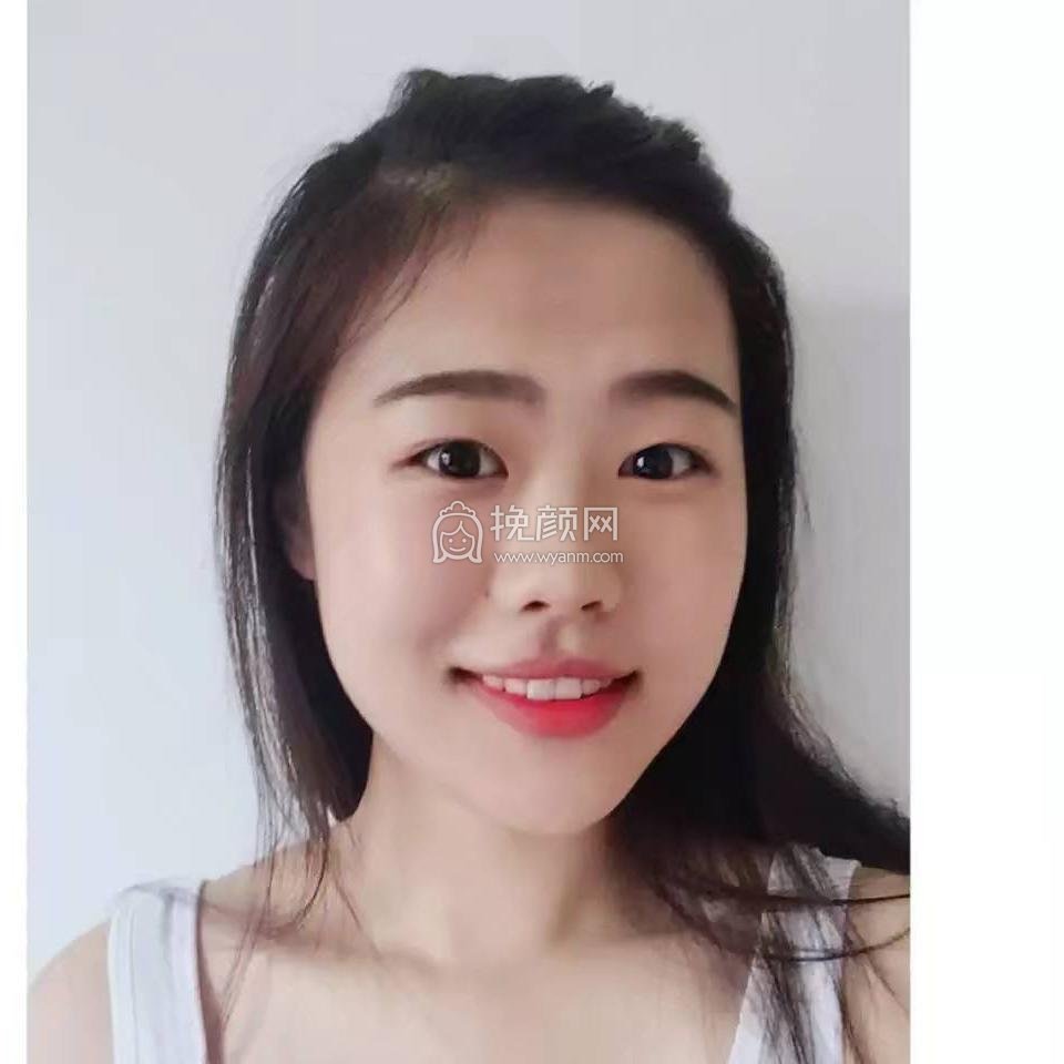 成都中医大银海医美何军做鼻子怎么样?