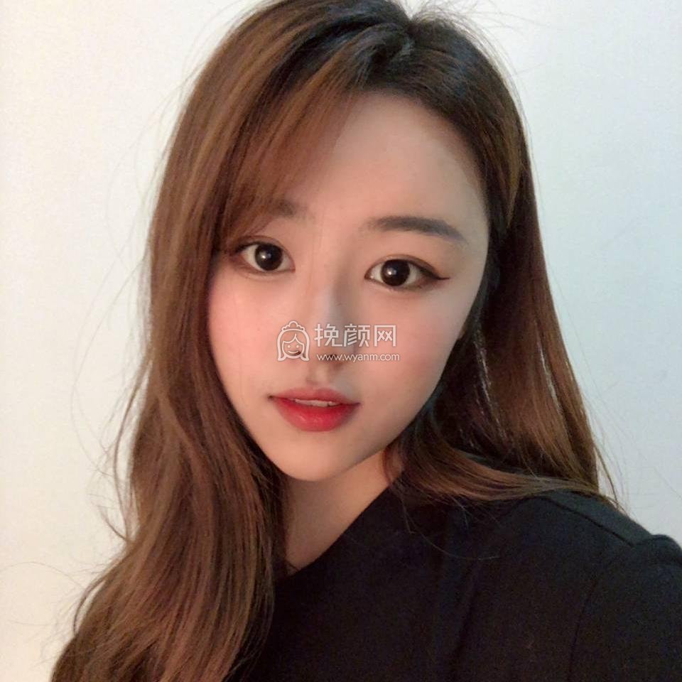 成都中医大银海医美何军做鼻子怎么样?