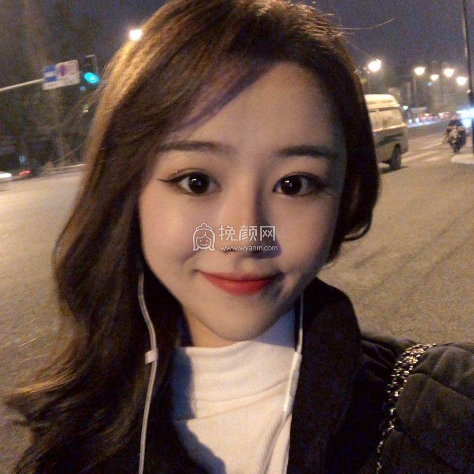 成都中医大银海医美何军做鼻子怎么样?