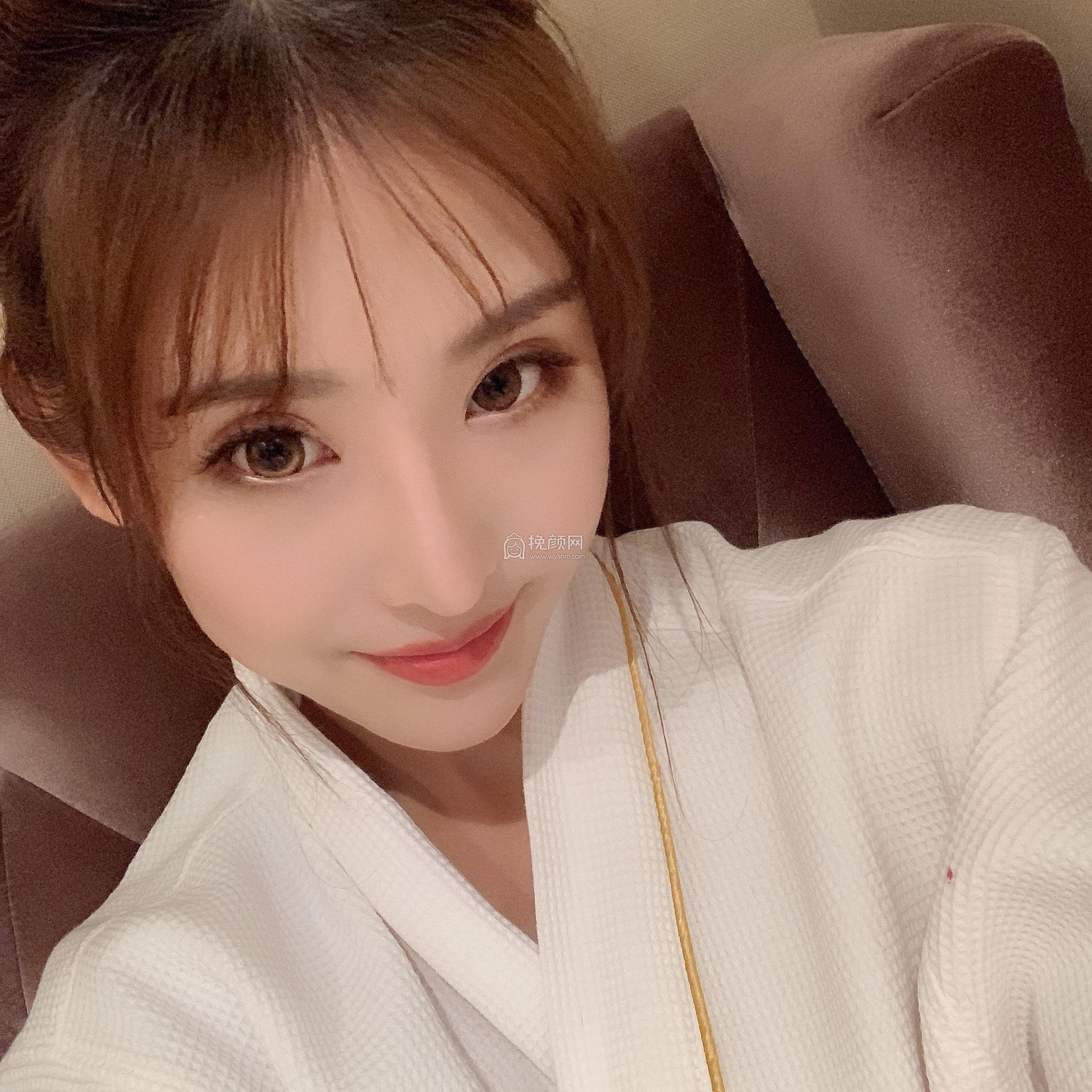 北京华悦府朱燕鼻部手术案例!