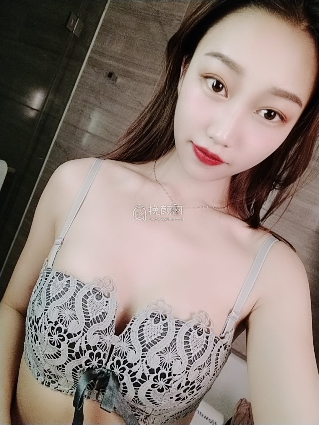 重庆美莱吴继东假体隆胸果如何?