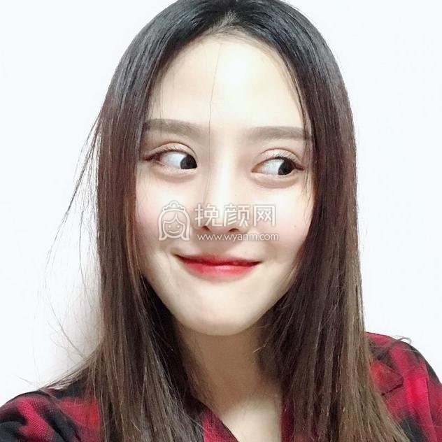 北京美莱王旭东做鼻子果怎么样?