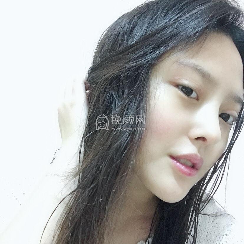 北京美莱王旭东做鼻子果怎么样?