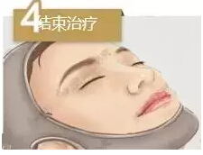 埋线提升提升术调节手术过程是怎样的呢?