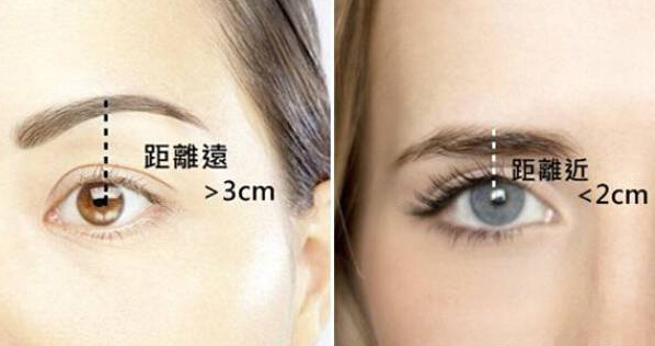 双眼皮,割多宽才好看?
