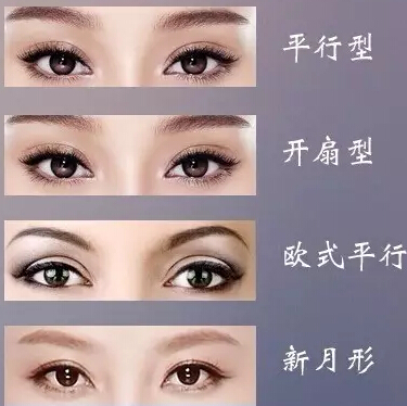 不要只顾好看!双眼皮术前这些问题你需要了解