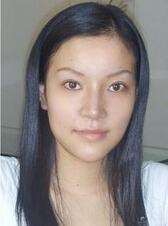以下是我的瘦脸经历,和大家一起分享一下