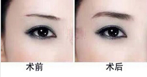 太原华美整形美容医院做纹眉术怎么样?