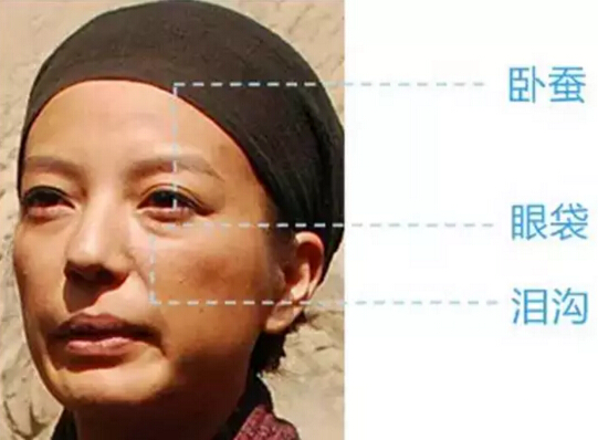 眼睛鼻子泪沟太阳穴手术设计果分享