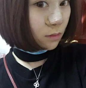 隆鼻2个月后,我居然瘦了这么多!