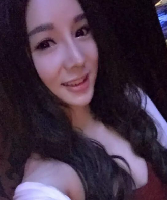 深圳盛美佳医疗整形美容张亚梅做的鼻部手术整形