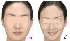 瘦脸哪家医院较好，北京黄寺美容外科怎么样？