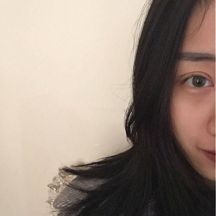 成都华西医院郭祥文做的双眼皮开眼角手术果