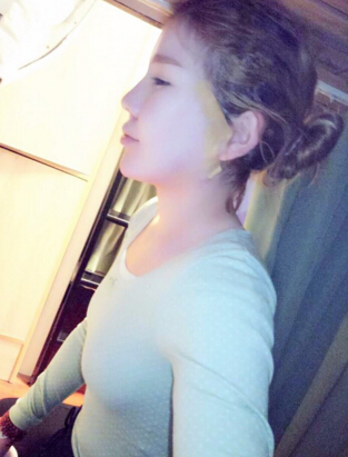 成都艾米丽医疗美容刘叔阳面部吸脂果