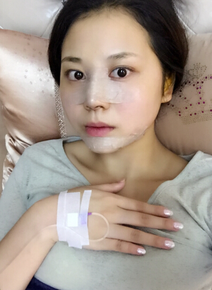 武汉悦丽汇东亭门诊吴明瑞自体软骨垫鼻尖果