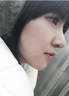 自体软骨隆鼻手术大概需要花多少钱?