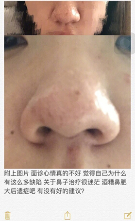 上海九院罗敏,韦敏医生做鼻子面诊反馈