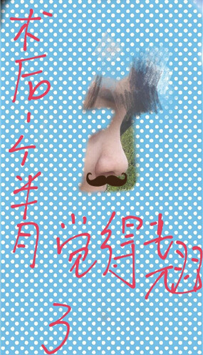 成都娇点整形姜宇禄做的鼻整形手术案例