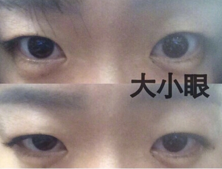 上海九院罗敏、周慧芳医生面诊反馈,求建议
