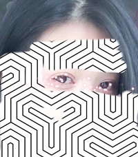 长沙湘雅附二王先成医生做的鼻部手术