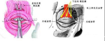 我的眼睛是不是睑下垂?到底要不要做提肌?