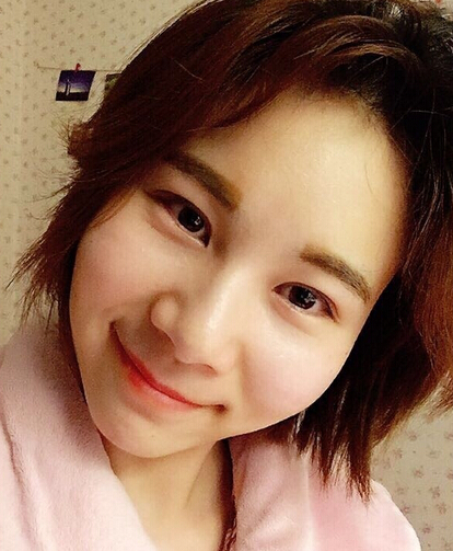 武汉天佑医院整形美容科做双眼皮怎么样?