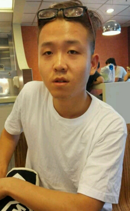 四川悦好医学美容医院杨丽璇打玻尿酸隆鼻果