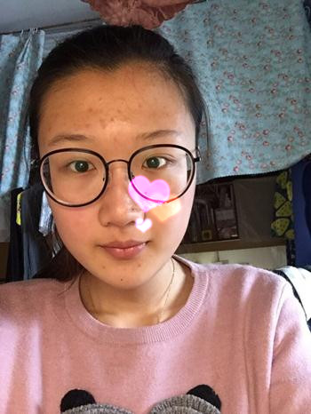 求问，我的脸型和眼睛鼻子皮肤该怎么做才好？