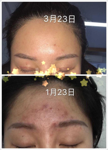 分享一些皮肤、口腔、双眼皮隆鼻的整形保养心