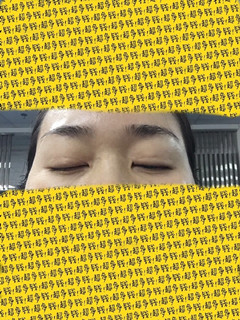 帮我看看我的双眼皮肉条和疤痕还有救吗?
