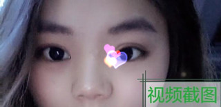 我的鼻子做单纯隆鼻,还是要鼻部手术?