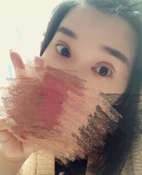 唐都医院刘纲医生做双眼皮开眼角果