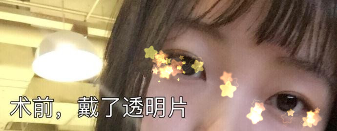 北京八大处王太玲做双眼皮果怎么样?
