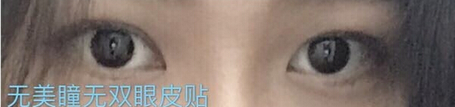 整形医院吕方中做双眼皮果好吗?