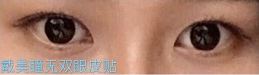 整形医院吕方中做双眼皮果好吗?