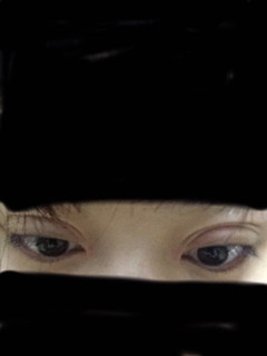 全切去脂去皮一个月不正常怎么办?