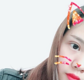 李芸医生做的双眼皮,问一下鼻子怎么做?