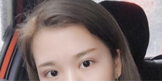李芸医生做的双眼皮,问一下鼻子怎么做?