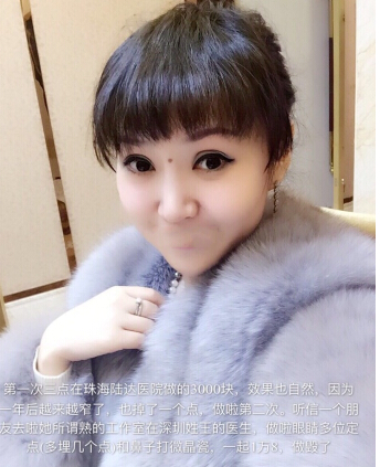 深圳美立达做的双眼皮修复和鼻部手术手术