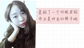 郑州都市风韵美容门诊做双眼皮开眼角果